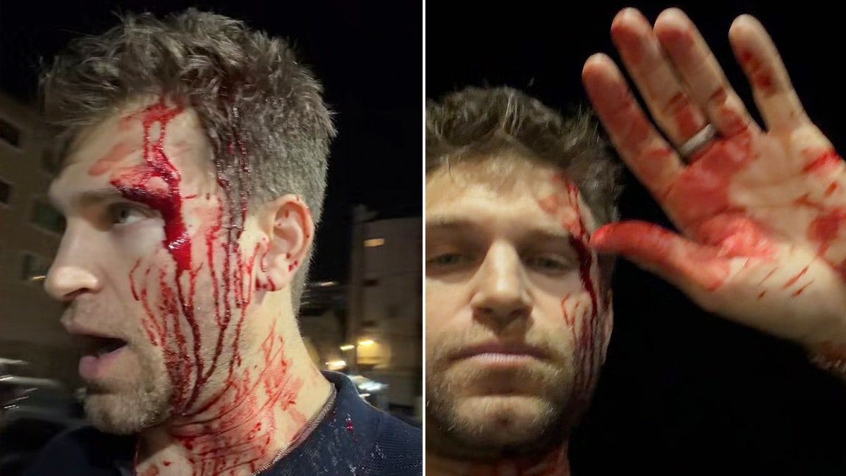 Split photo of Keegan Allen with blood on his face and neck raises a blood-covered hand.