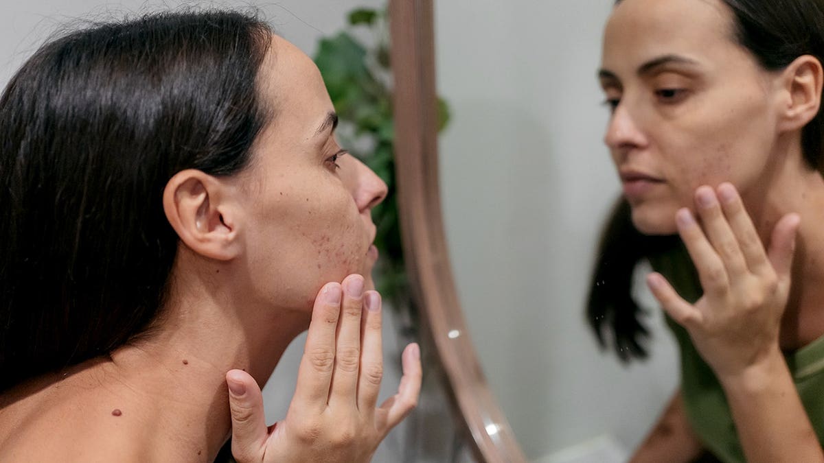 Woman applies acne scar cream to her face in a bathroom mirror.