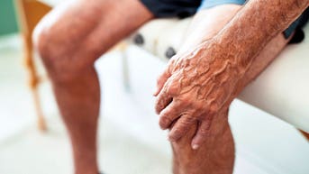 Tiny gelatin particles injected into joints may spare millions from replacement surgery - Fox News