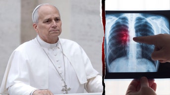 El tumor pulmonar del papa León plantea dudas sobre el riesgo de cáncer en los no fumadores - Fox News